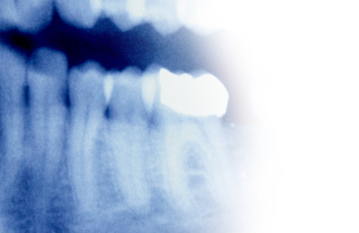 Endodontie